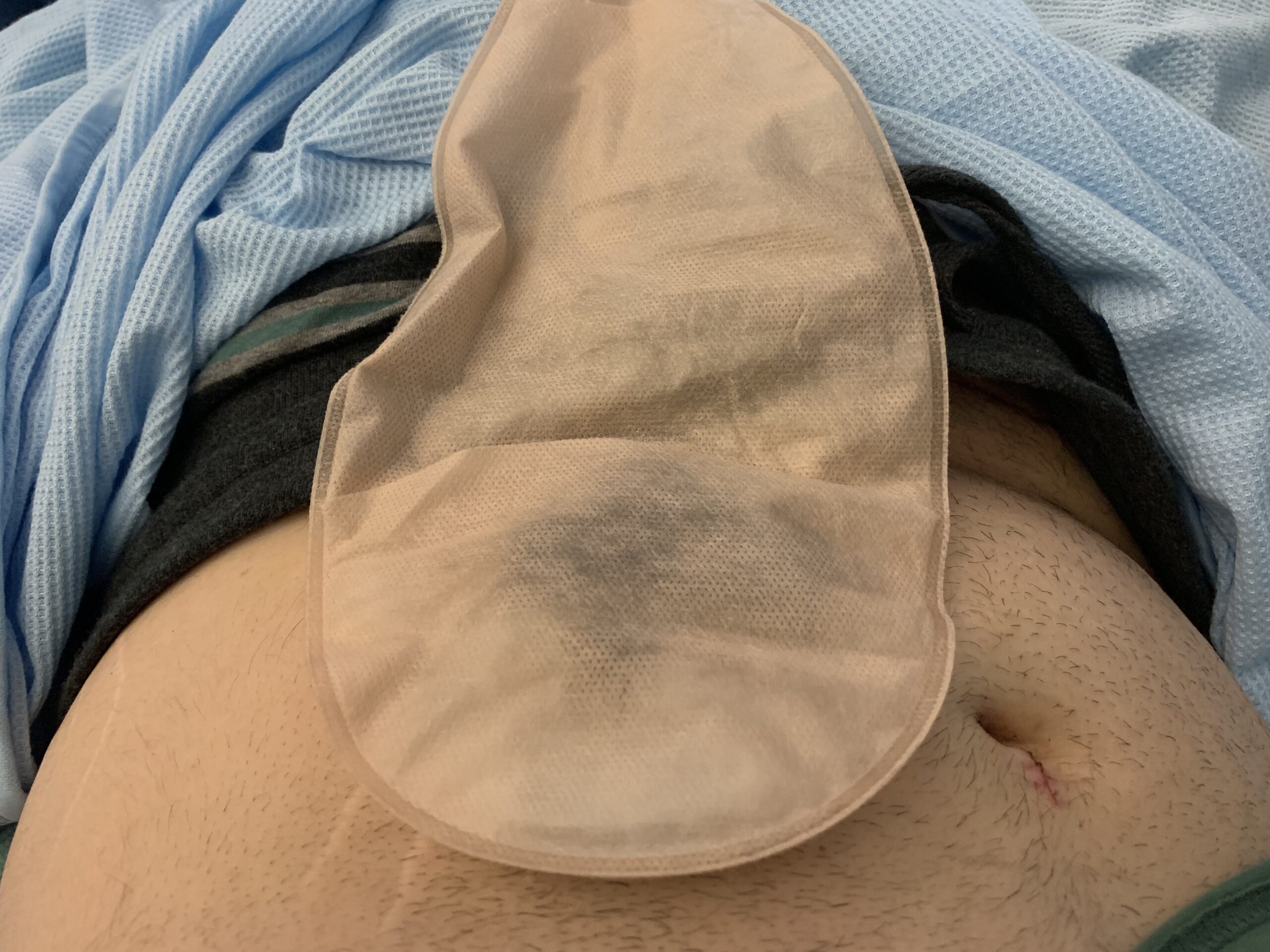 One-piece colostomy bag - Ostomy Care - Home Care Equipment - Fu Kang  Healthcare Supply Online Shop